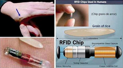 rfid chip in venezuela|A Brave New World: Use of Biometric Identifiers and RFID Chips .